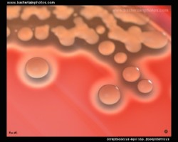 streptococcus zooepidemicus on agar